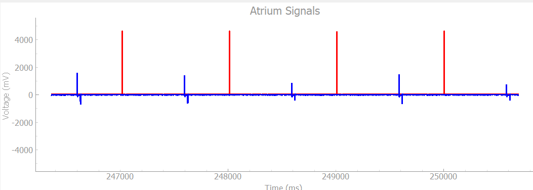 Heartview Output Showing Simulated Pacing